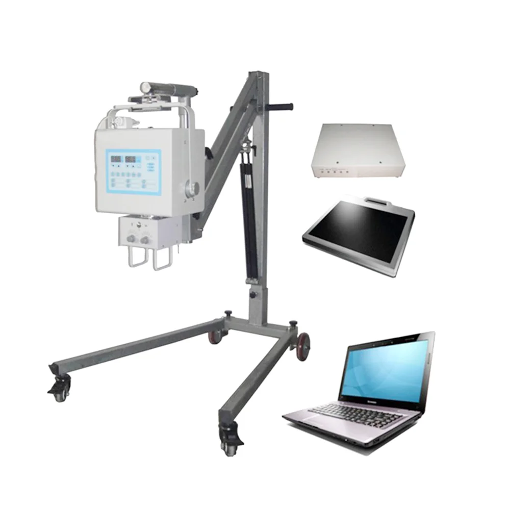 4KW High frequency x ray system medical digital Xray equipment portable x-ray machine digital for radiology
