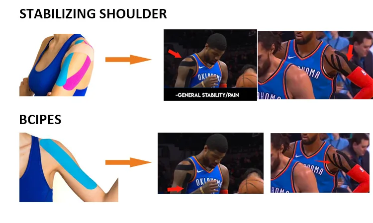 Paul George shoulder