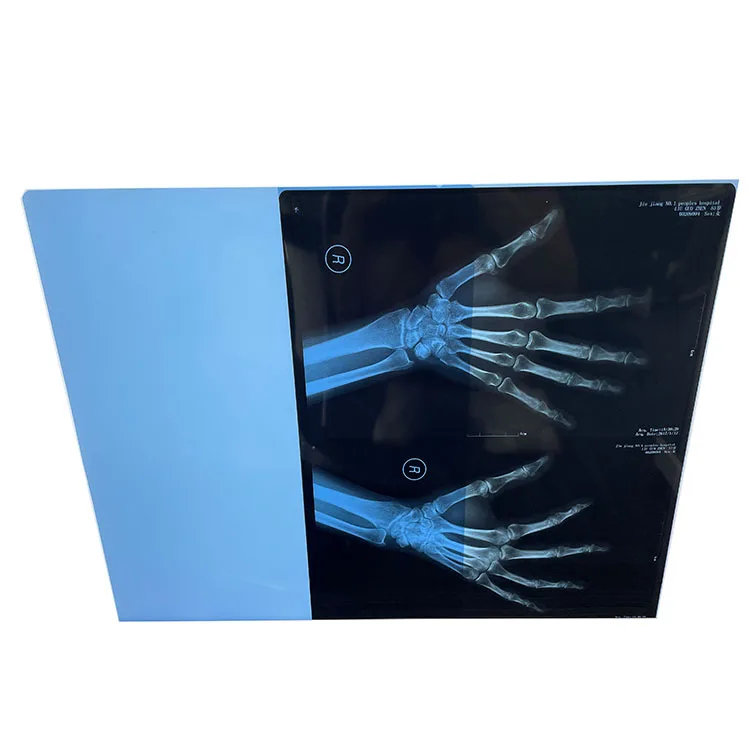 Full size blue dry thermal imaging x-ray film to be used on thermal printer