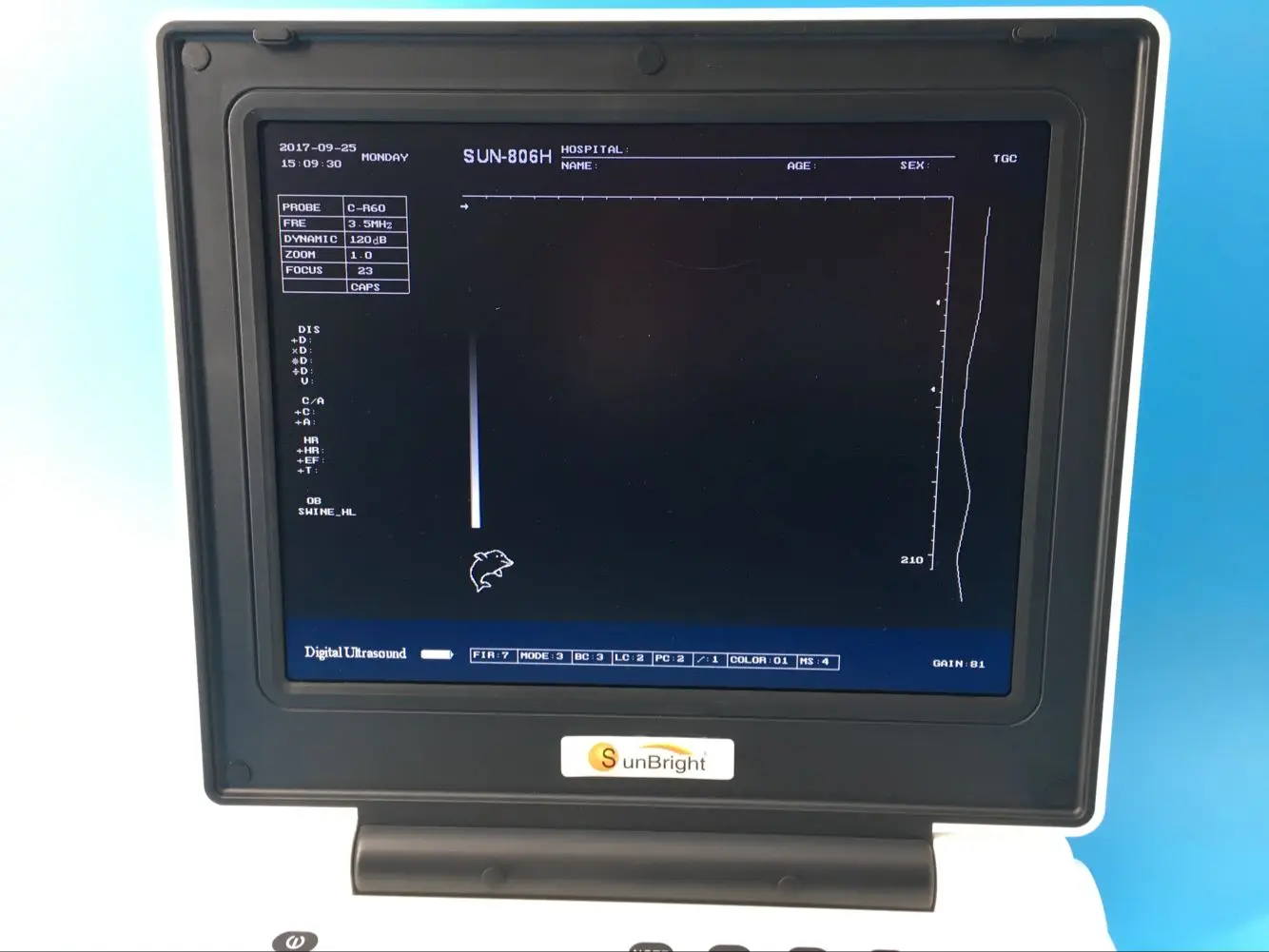 Sunbright Ecograph Laptop notebook Portable OB GYN Ultrasound
