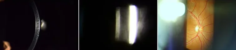 Professional SLM-3ER with Highest Quality Best Price Digital Slit Lamp Ophthalmic equipment ophthmology instrument