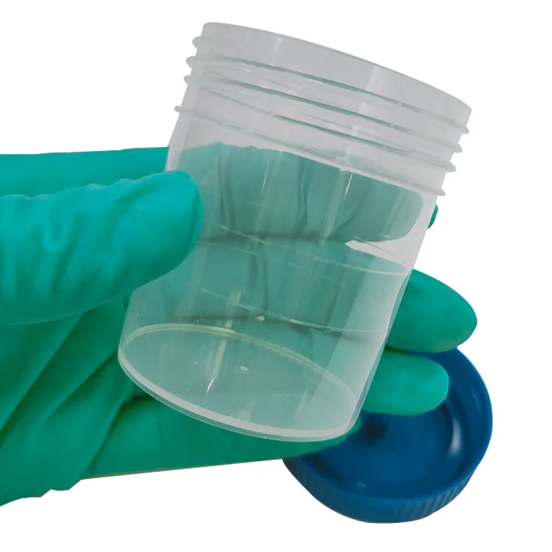 Factory direct hot sale disposable sterile specimen urine containers 60ml urine sample cup