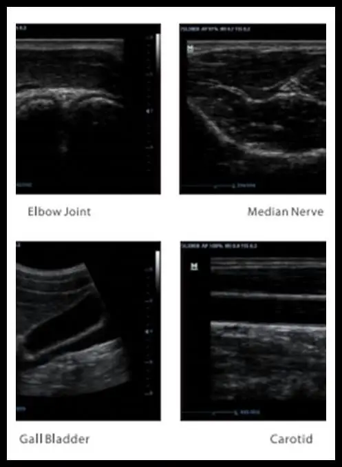 Ergonomic Digital Mindray DP20 Price / Summer Sale!! Portable 12.1 Inch LED Black & White Ultrasound