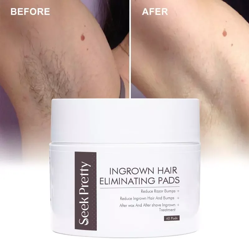 2024 Private Label Body Facial 40 Pads Glycolic Salicylic Acid Exfoliant Ingrown Hair Peeling Exfoliating Pads