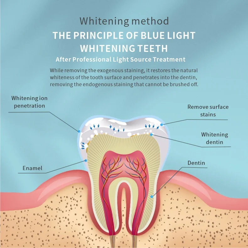 Factory Sell Private Logo LED Light Carbamide Peroxide Non Peroxide Gel Teeth Whitening Home Kits