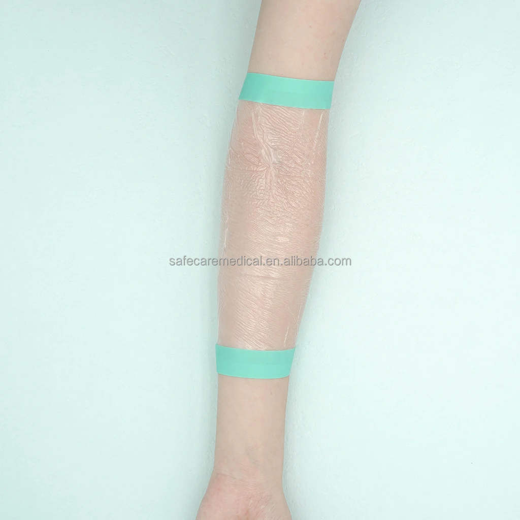 30x40cm Breathable and waterproof sterile PU/PE film surgical film surgical adhesive film without iodine for NPWT dressings