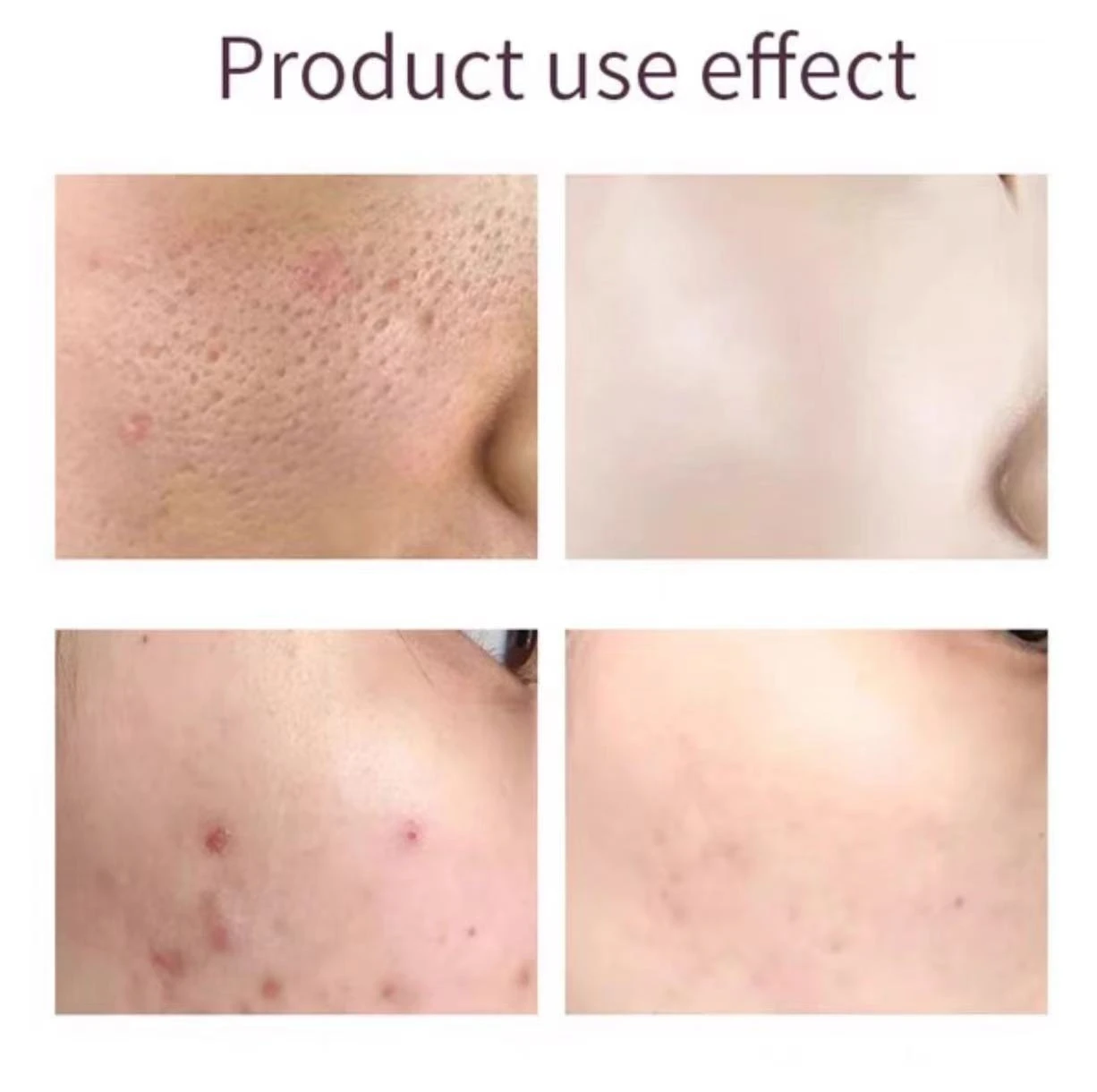 Hot sell Private Label Whitening Skin Care Exfoliating Remove Acne Scars Facial Serum Glycolic AHA 30% BHA 2% Peeling Solution