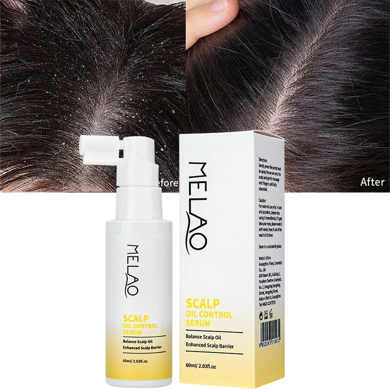 Natural Scalp Serum Anti Itching Soothing Dry Itchy Scalp Serum Oily Scalp Treatment