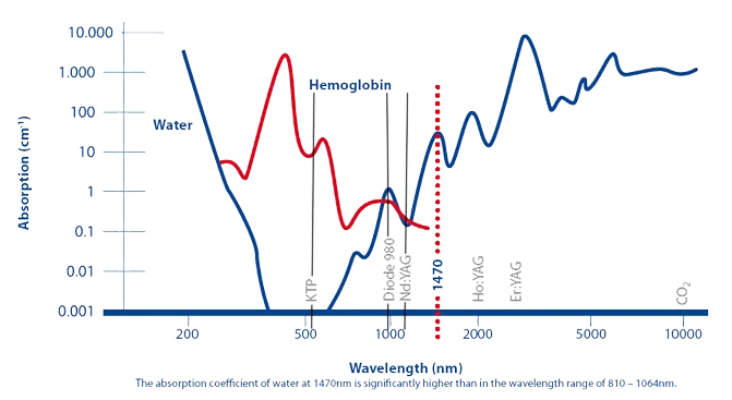 980nm 15watt  Lightweight Hemorrhoid Treatment Laser Proctology surgery diode laser machine