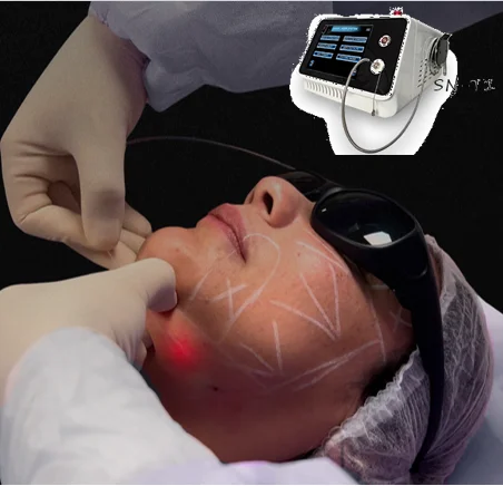 Factory Price red Blood spader vein removal 980nm 1470nm diode laser vascular removal machine for SaleFDA