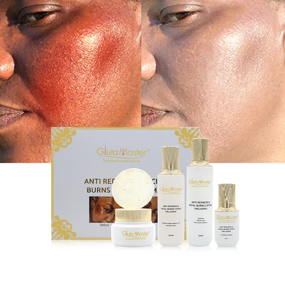 Крем для лица с защитой от покраснения