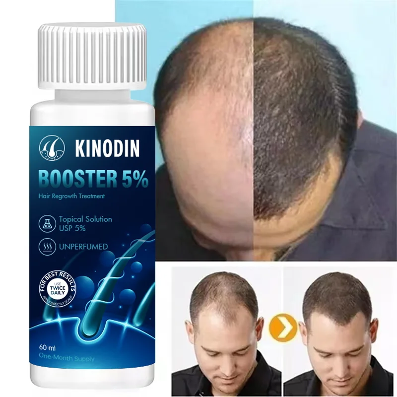 Custom logo hair growth serum treatment hair serum oil professional natural KINODIN oil with derma roller kit