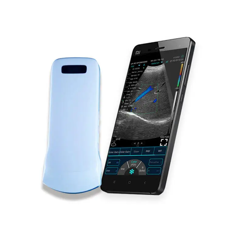 Portable Color doppler 3 in1 wireless Ultrasound scanner Handheld device convex linear phase array probe Ultrasound