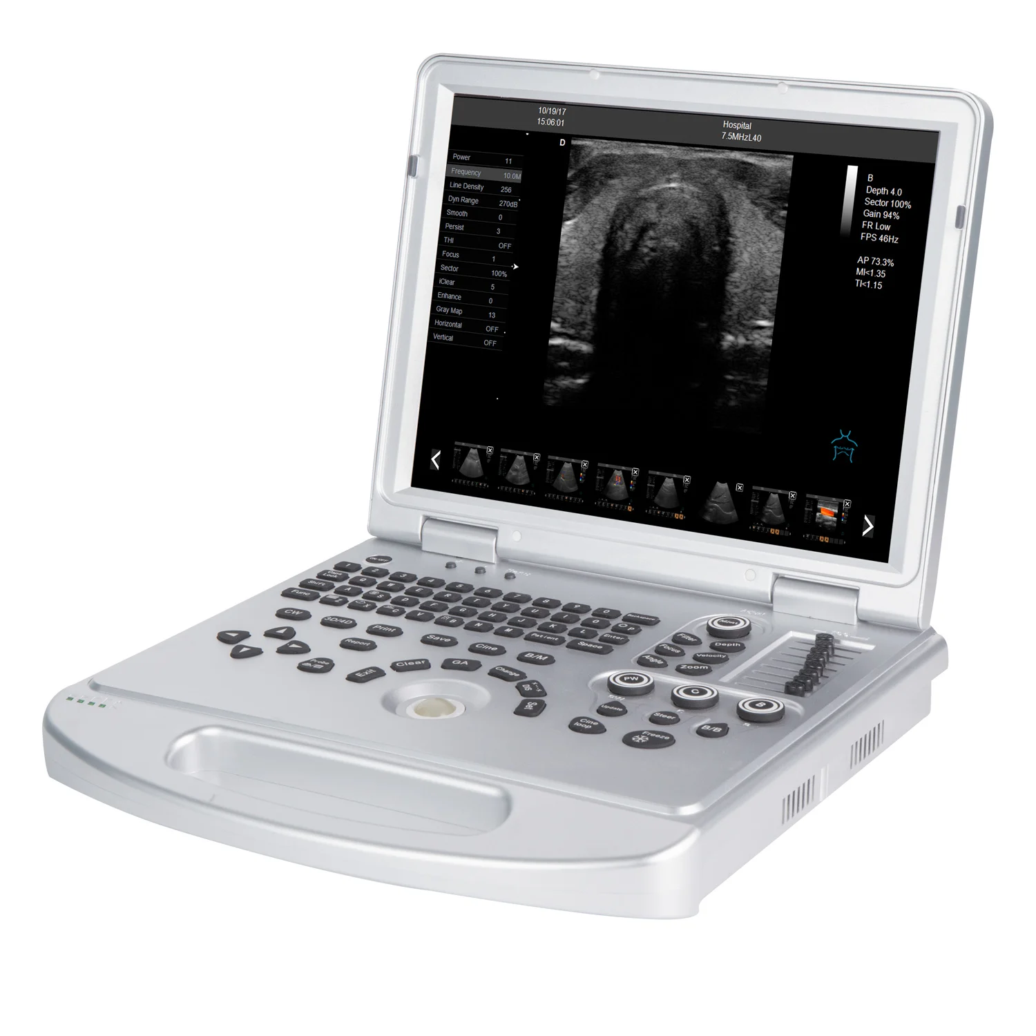 15-inch high resolution LED monitor medical ultrasound scanner