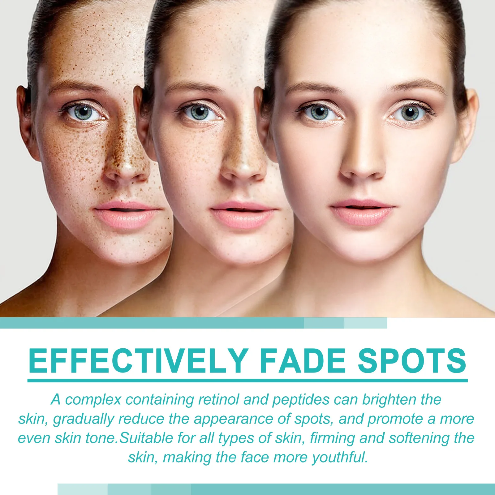 Organic Whitening Anti Freckle Face Care Cream For Pigment Melasma Acne Pimples Dark Spot Corrector with Support customization