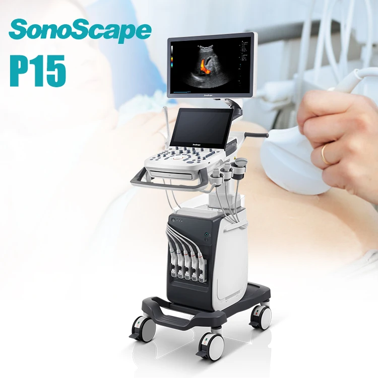 3D/4D Snoscape P15 диагностический Цветной Допплер ультразвук