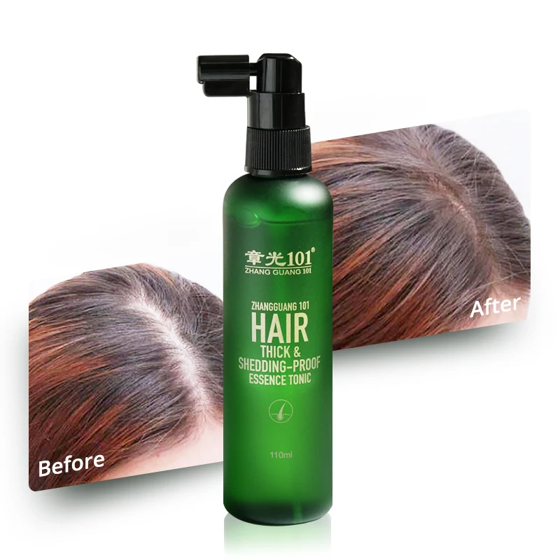 Zhangguang 101 Hair Loss Treatment Fast Hair Growth Spray Tonic