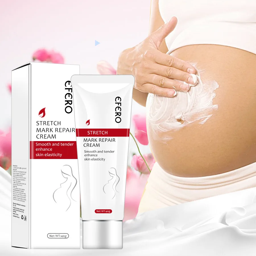 
Organic Natural Stretch Marks Remove Acne Scar Treatment Cream For Pregnancy Repairing Scars for Women Private label 