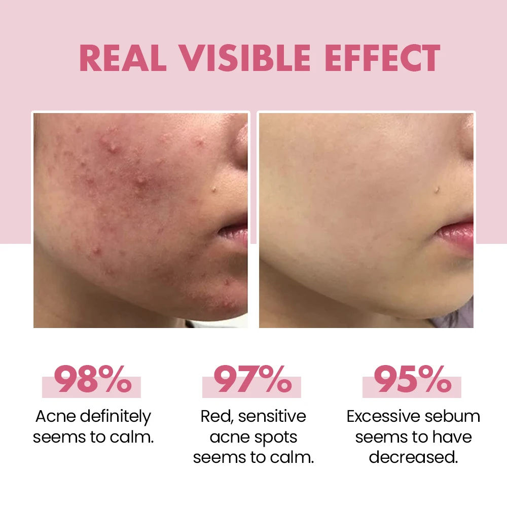 Oem Best Cosmetics Organic Face Washing Products Anti Inflammatory Niacinamide Face Wash Jelly Facial Cleanser Private Label