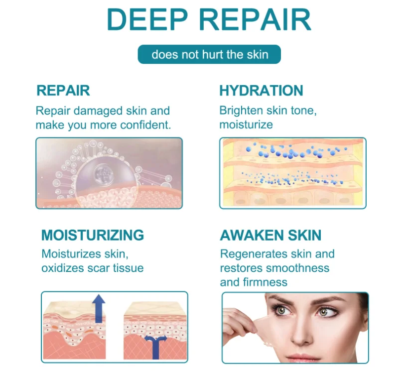 High Quality Roll Shape 4cmx1.5M silicone scar sheets New products Factory Price Silicone Gel Scar Away Sheets for Scars removal