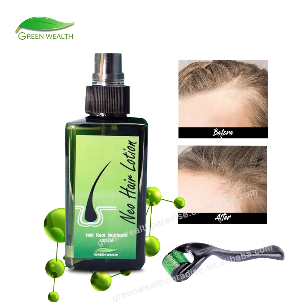 Neo Hair Lotion Green Wealth 120ML Made In Thailand  Original Paradise Hair Growth Oil