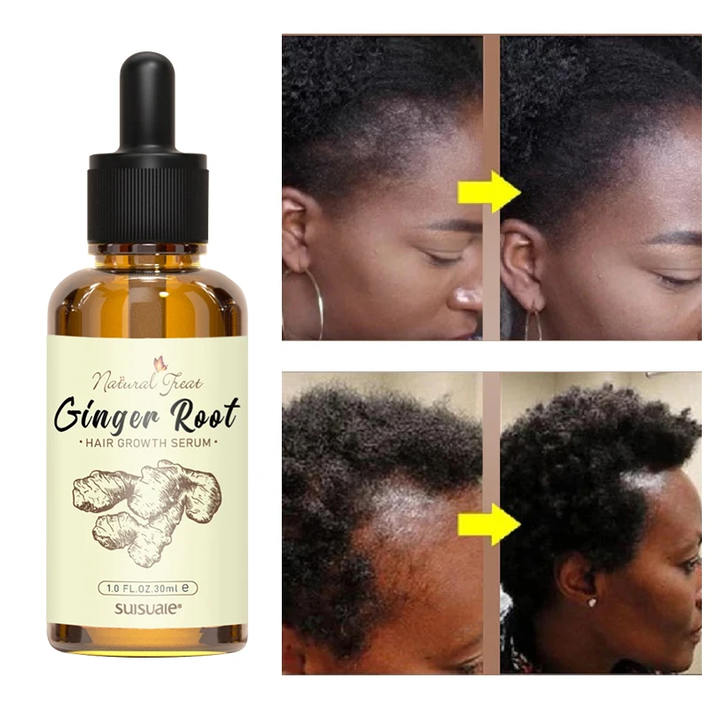 50 Moq Custom Private Label Best Black Women Natural Organic Herbal Ginger Hair Growth Oil Serum For Men Woman