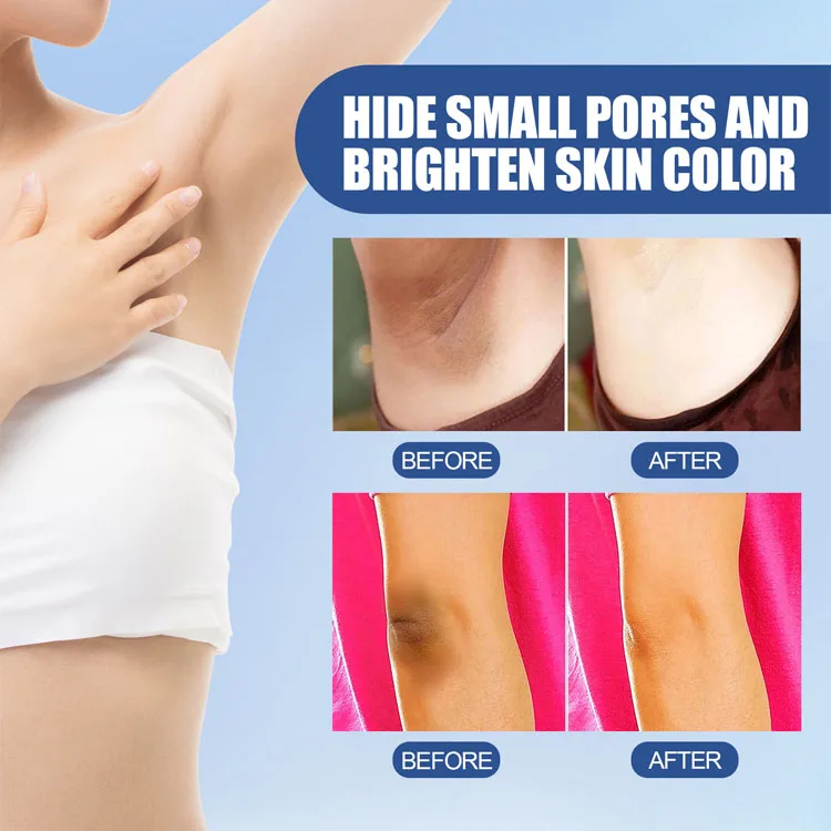 EELHOE Underarm Whitening Cream Sensitive Parts Brightening Underarm Skin Brightening Cream