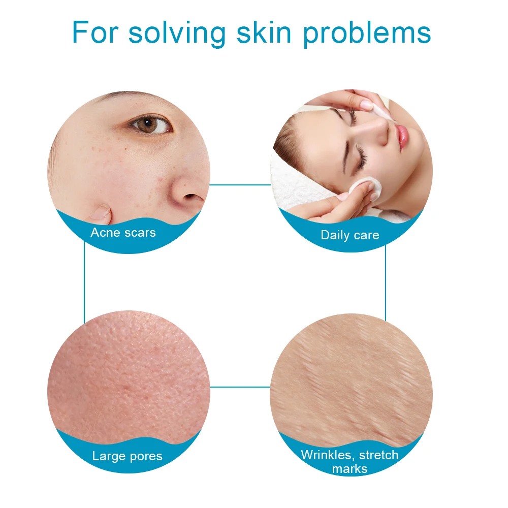 Микро-игольчатый ролик Derma 540 Иглы 0 2-3 мм для кожи головы микро-ролик