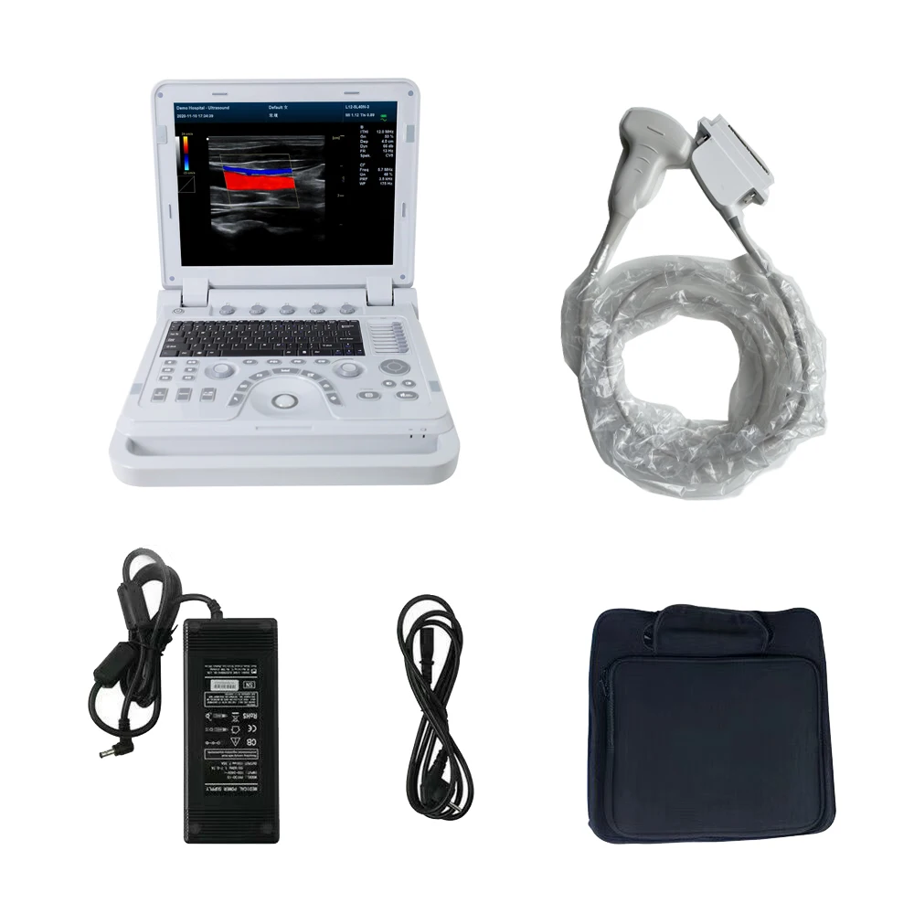 CONTEC CMS1700B Акушерская Урология живота кардиопедическая гинекология периферическая сосудистая диагностика Цветной Допплер