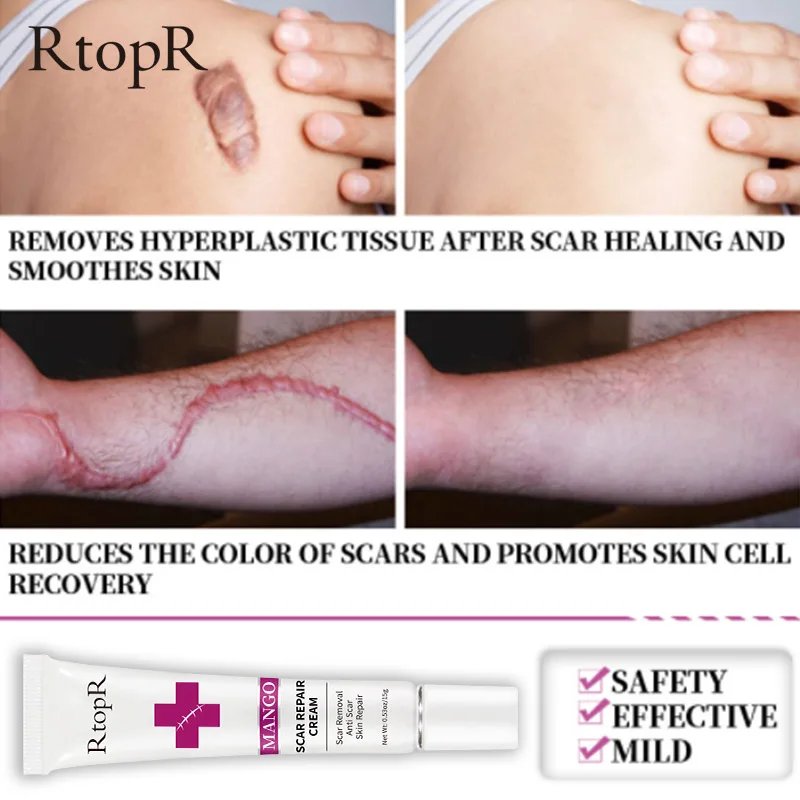 RtopR Acne Scar Stretch Marks Remover Cream Skin Repair Face Cream Acne Spots Acne Treatment Blackhead Whitening Cream Skin Care