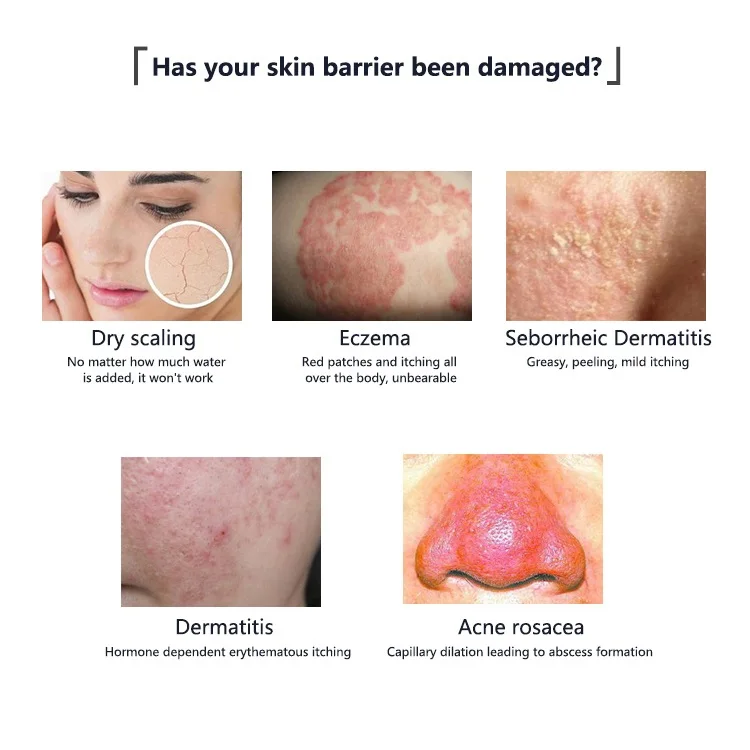Plastic Surgery Medical Grade Humanized Type III Collagen Sterile Care Repair Dressings Cream for PMU Microblading Aftercare