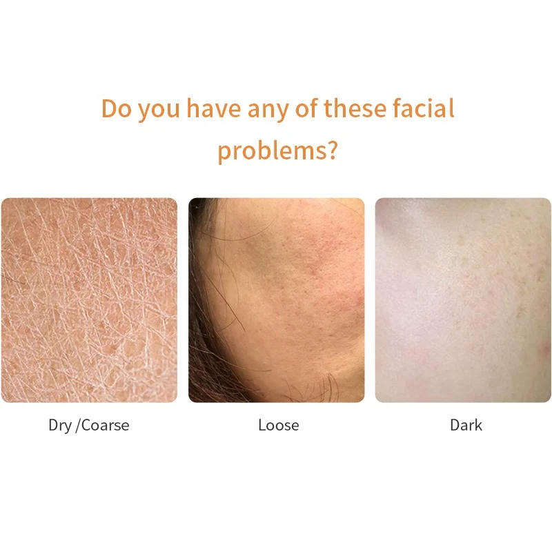 Wholesale New Arrival Oem Skin Brightening Whitening and remove acne  Centella Asiatica Silk mask