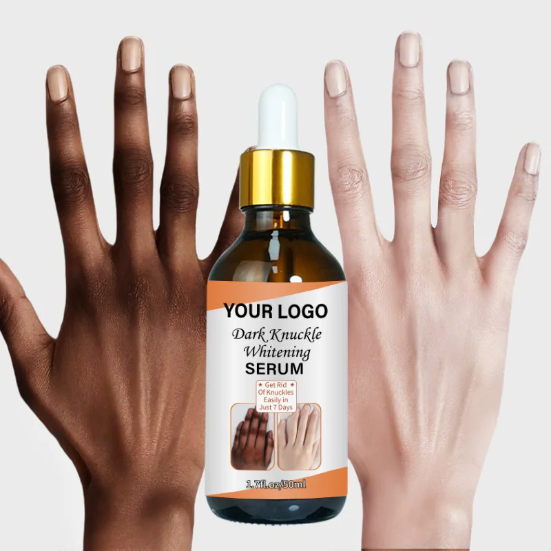 Фирменная Сыворотка для быстрого отбеливания суставов колена, сыворотка для удаления интенсивных пятен на коленях