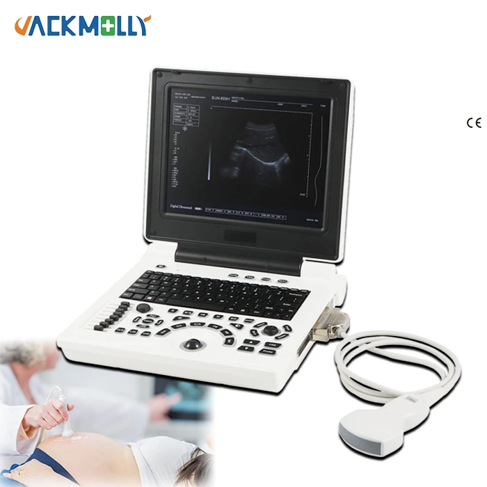 CE hospital clinic ultrasound for human MSK GYN JM-806H machine ecografo sonoscape