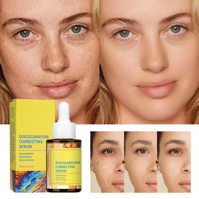 OEM ODM Anti Aging Lift Brightening Skin Care Hyaluronic Acid Vitamin C E Peptide Collagen Facial Discoloration Correcting Serum