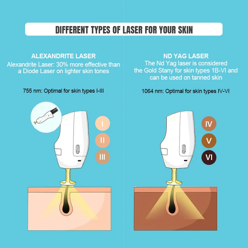 Factory Price Lufenbeauty OEM ODM 755nm permanent hair removal alexandrite laser hair removal 755nm laser alexandrite machine