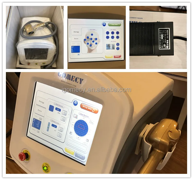  Er-Yag-laser-erbium-glass-fractional-laser/ 1550nm -erbium-glass-fiber-laser-stretch-mark-treatment  1550nm-fiber-erbium-glass-laser acne-treatment-machine 1550nm-erbium-glass-fiber-laser