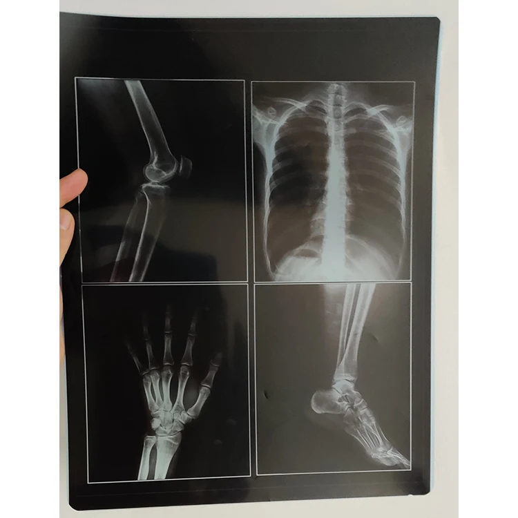 
medical dry imaging film DI-HT 