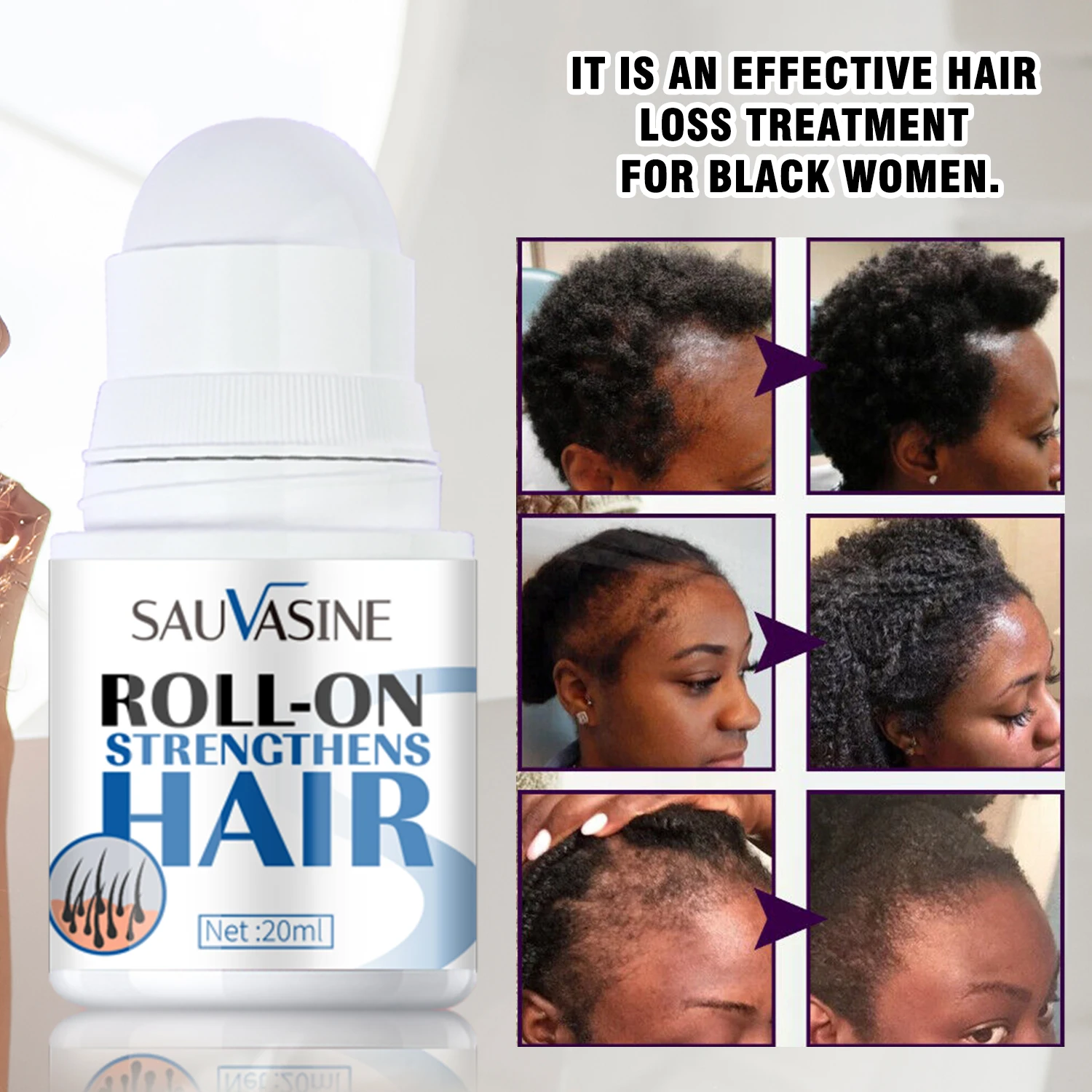 OEM Hair Growth Oil Hair Loss Treatment Repair Split Dry Damaged Roll On Strengthens Hair