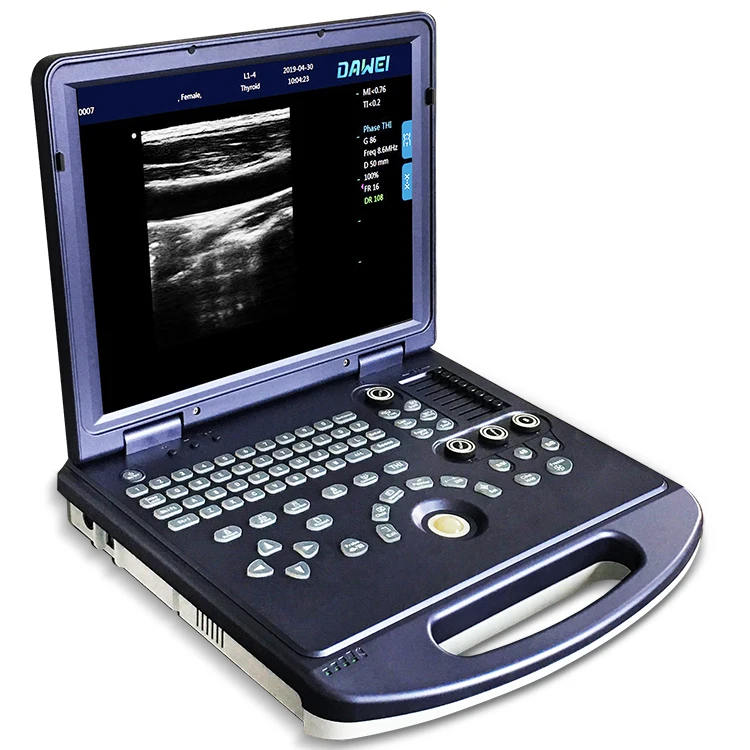 Ультразвуковая портативная ультразвуковая машина по конкурентоспособной