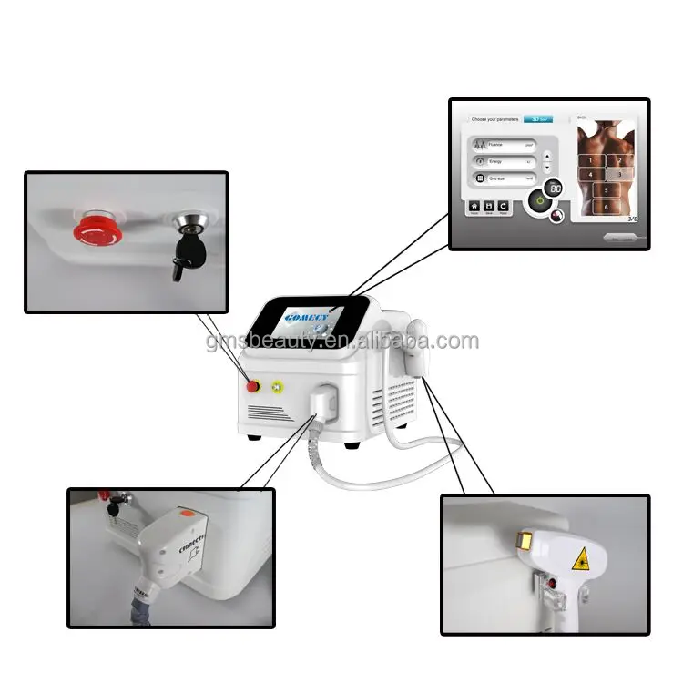 Epilation with a diode laser hair removal with laser stock with triple wavelengths