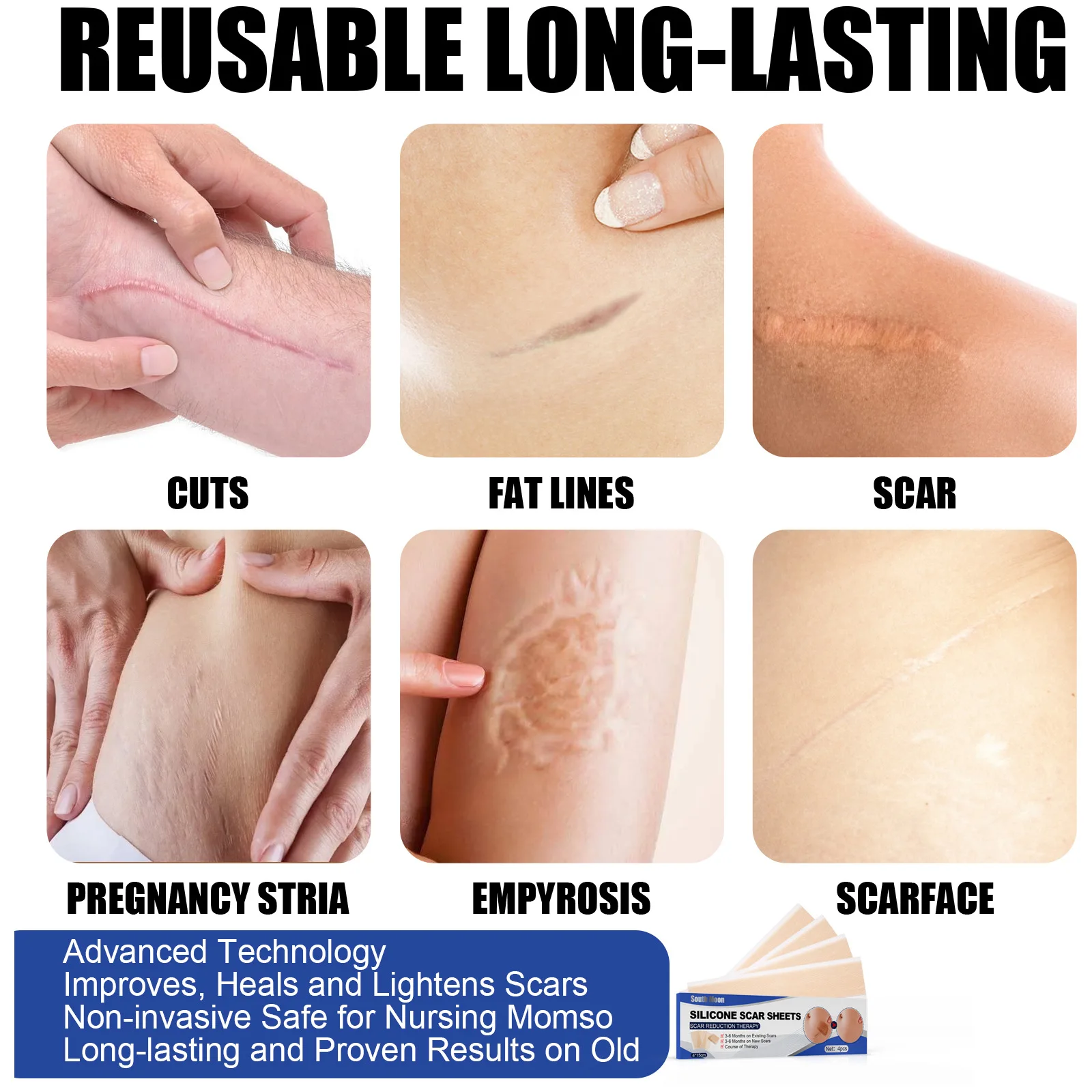 South Moon Silicone Patch Scars Scar Away Gel Sheets Silicone Scar Removal Sheet with size 7.5*4cm