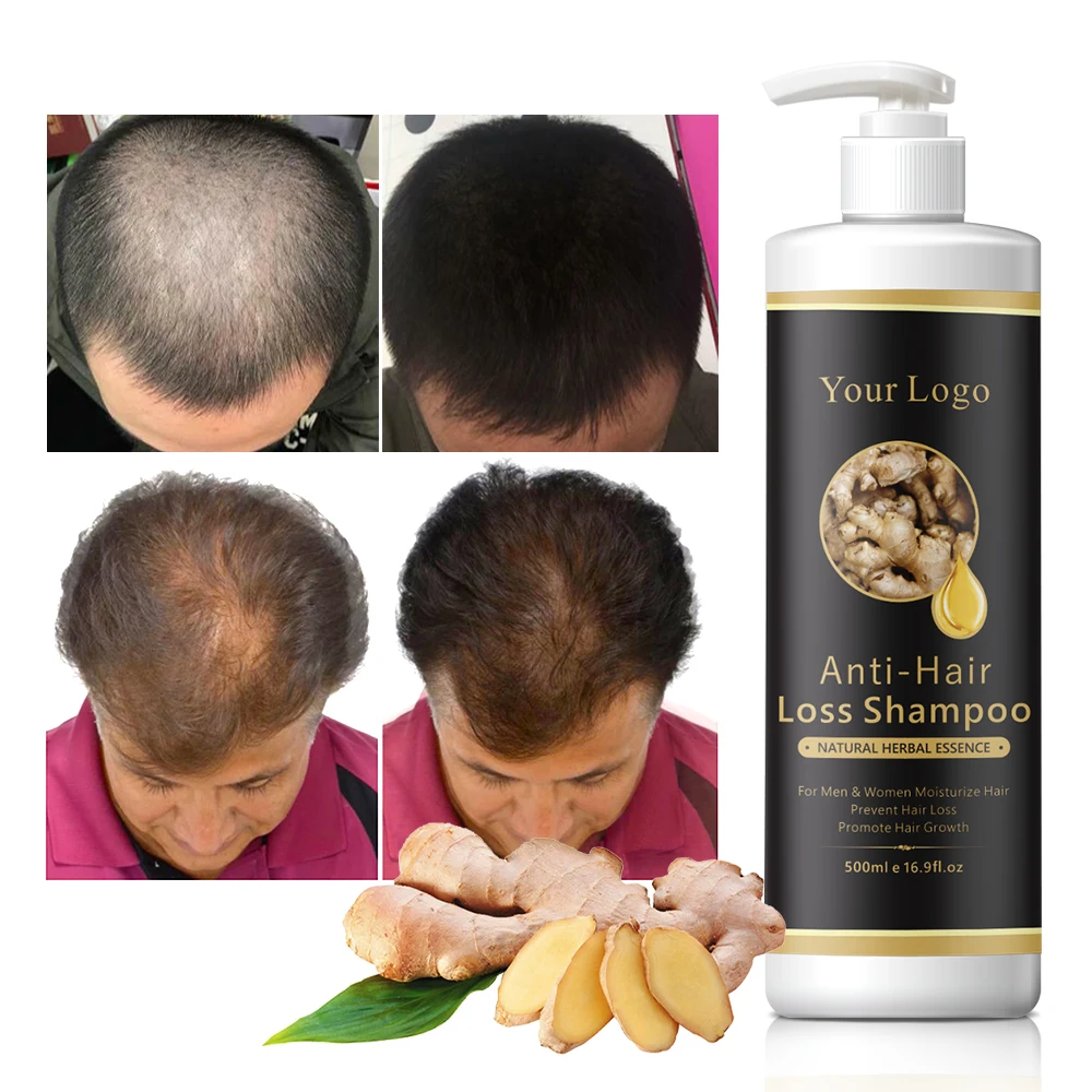 Custom Logo Hair Loss Shampoo Repairing Treatment Fast Anti Loss Hair Growth Shampoo
