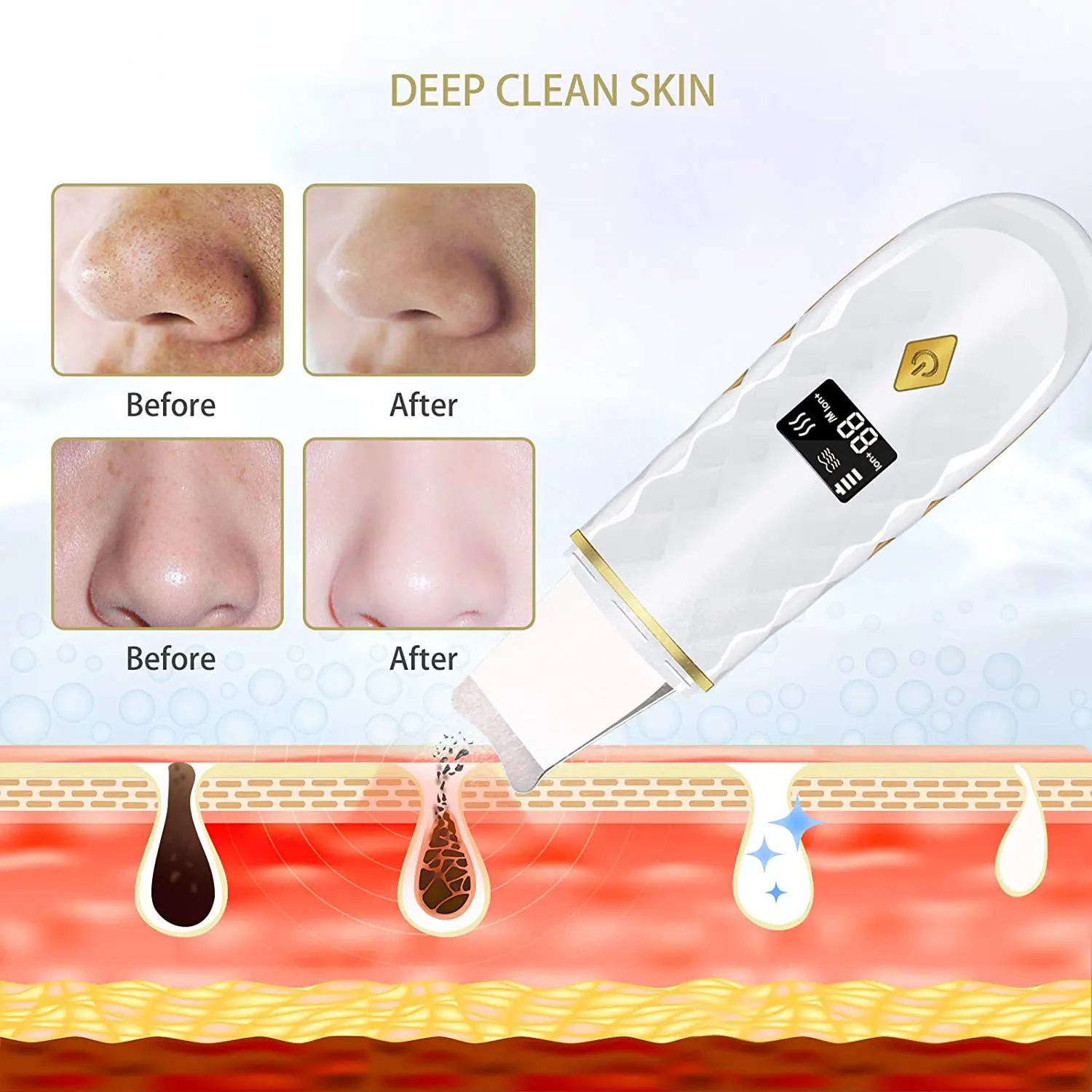 Led Display Wireless Ion Sonic Deep Cleansing Pore Cleaner Comedo Blackhead Remover Face Scraper Spatula Skin Facial Scrubber