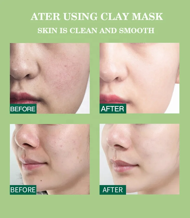 OEM ODM Low Moq Custom Logo Organic Face Beauty Skin Care Clay Mud Mask