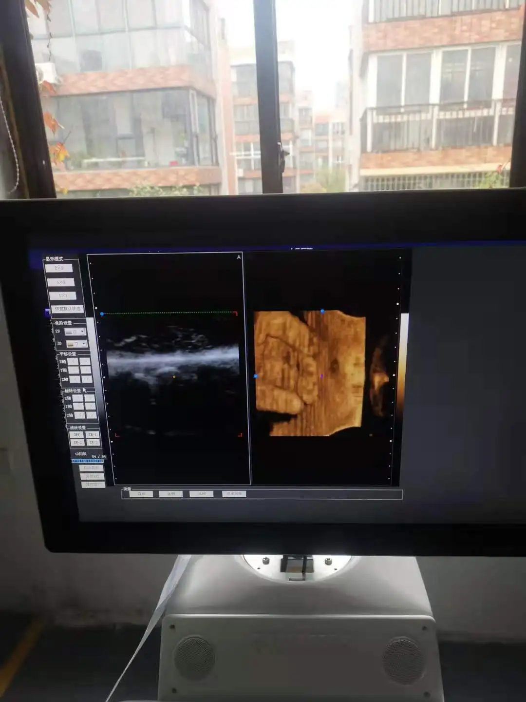 Ruihua brand  3d/4d CW Color Doppler Ultrasound echo machine convex linear