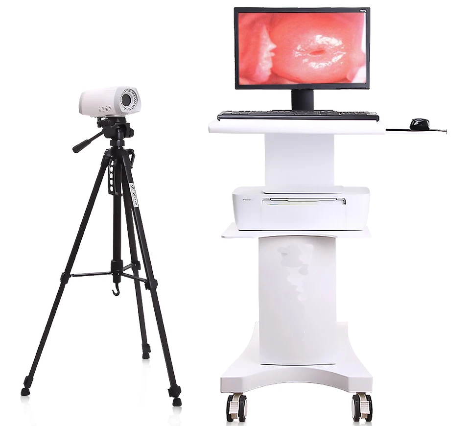 
Medical digital vagina Colposcope/Trolley Video Colposcope price for gynecology 