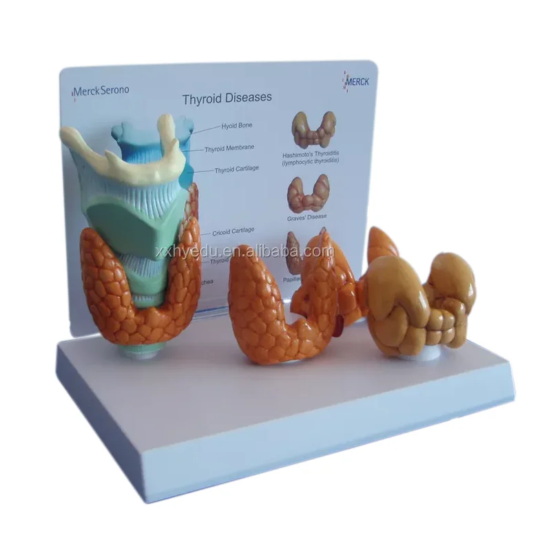 Factory direct sell Thyroid diseases educational model
