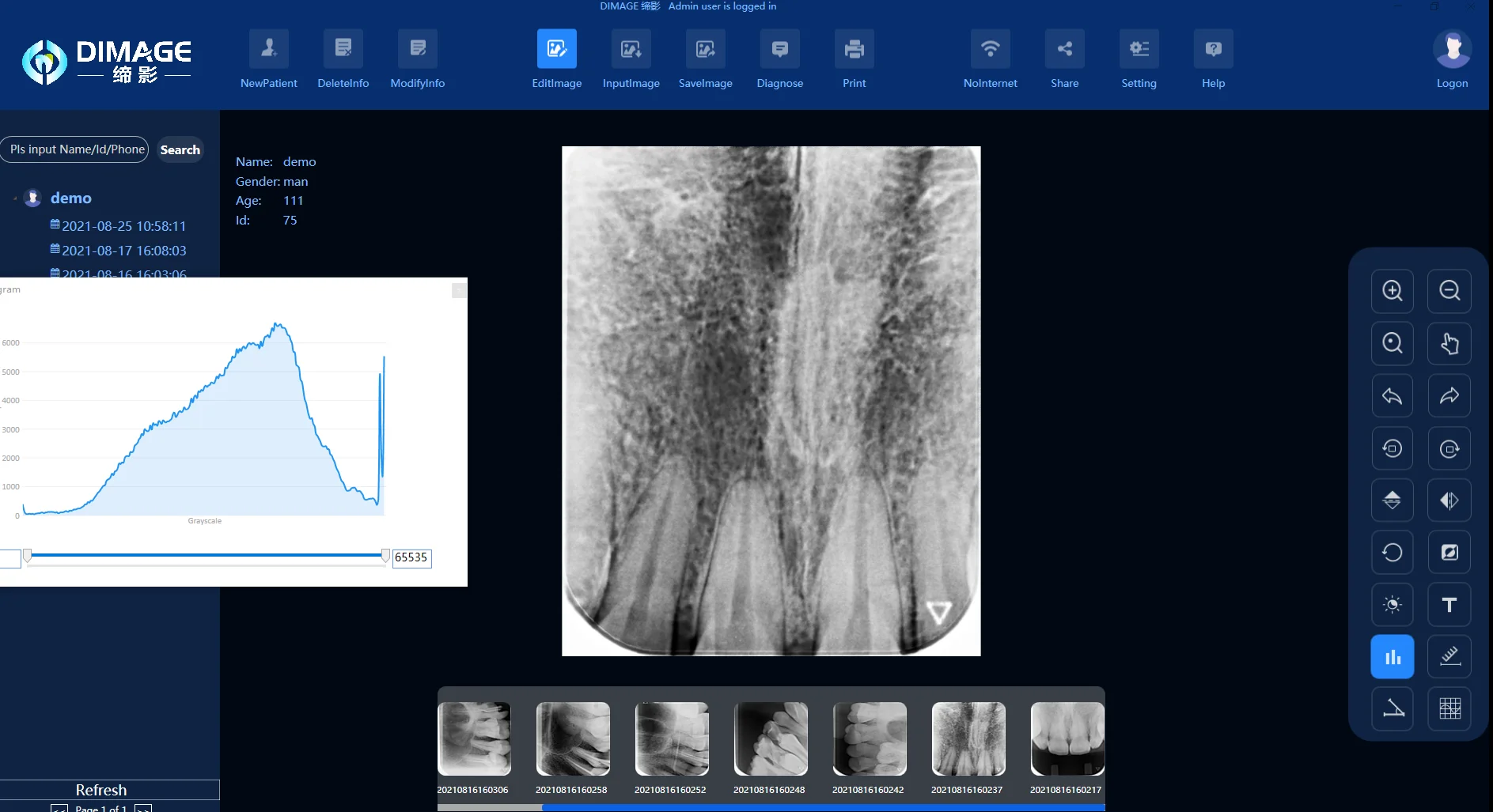 Dynamic Hot Imaging Success Rate 99% Sell Dental Equipment Dental Intraoral CR Imaging Plate Scanner