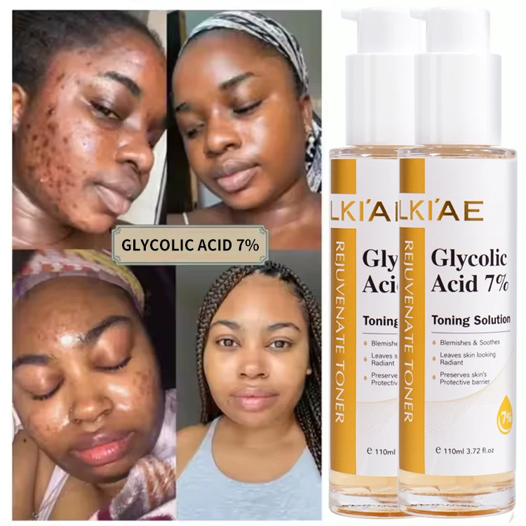 Private Label 7% Glycolic Acid AHA Exfoliating Toner Lactic Acid Witch Hazel Smoothing Pore Refining Skin Care for All Skin Type